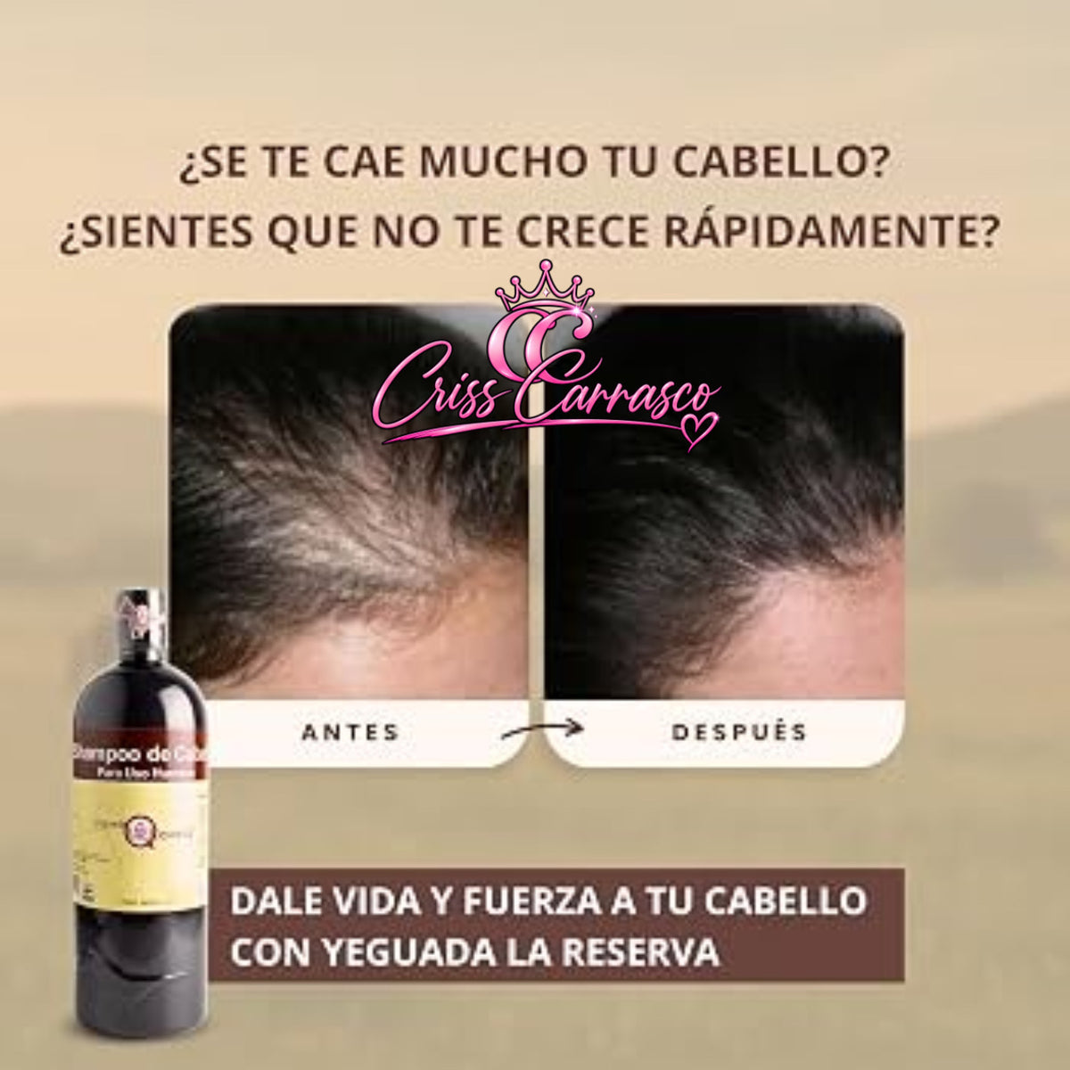 SHAMPOO LA YEGUADA